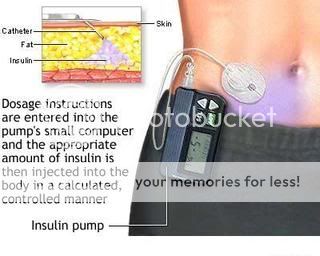 La terapia del diabete: Il Microinfusore