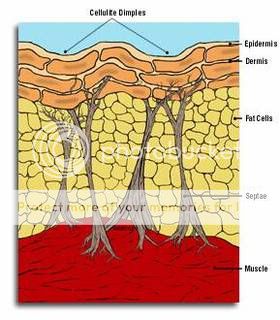 Alterazioni di peso: cellulite, obesità, magrezza eccessiva